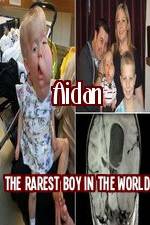 Watch Aidan The Rarest Boy In The World 5movies