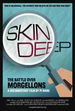 Watch Skin Deep: The Battle Over Morgellons 5movies