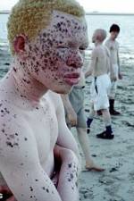Watch Albino United 5movies