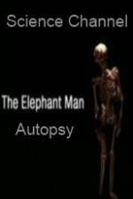 Watch Science Channel Elephant Man Autopsy 5movies