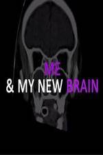 Watch Me & My New Brain 5movies
