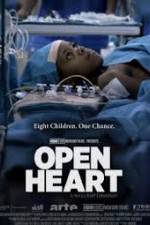 Watch Open Heart 5movies