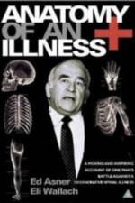 Watch Anatomy of an Illness 5movies