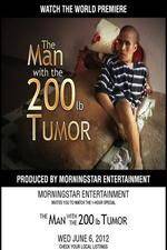 Watch The Man With The 200lb Tumor 5movies
