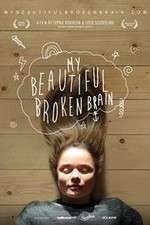 Watch My Beautiful Broken Brain 5movies