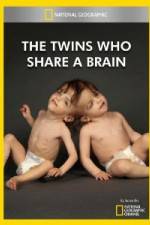Watch National Geographic The Twins Who Share A Brain 5movies