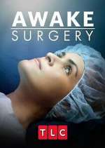 Watch Awake Surgery 5movies